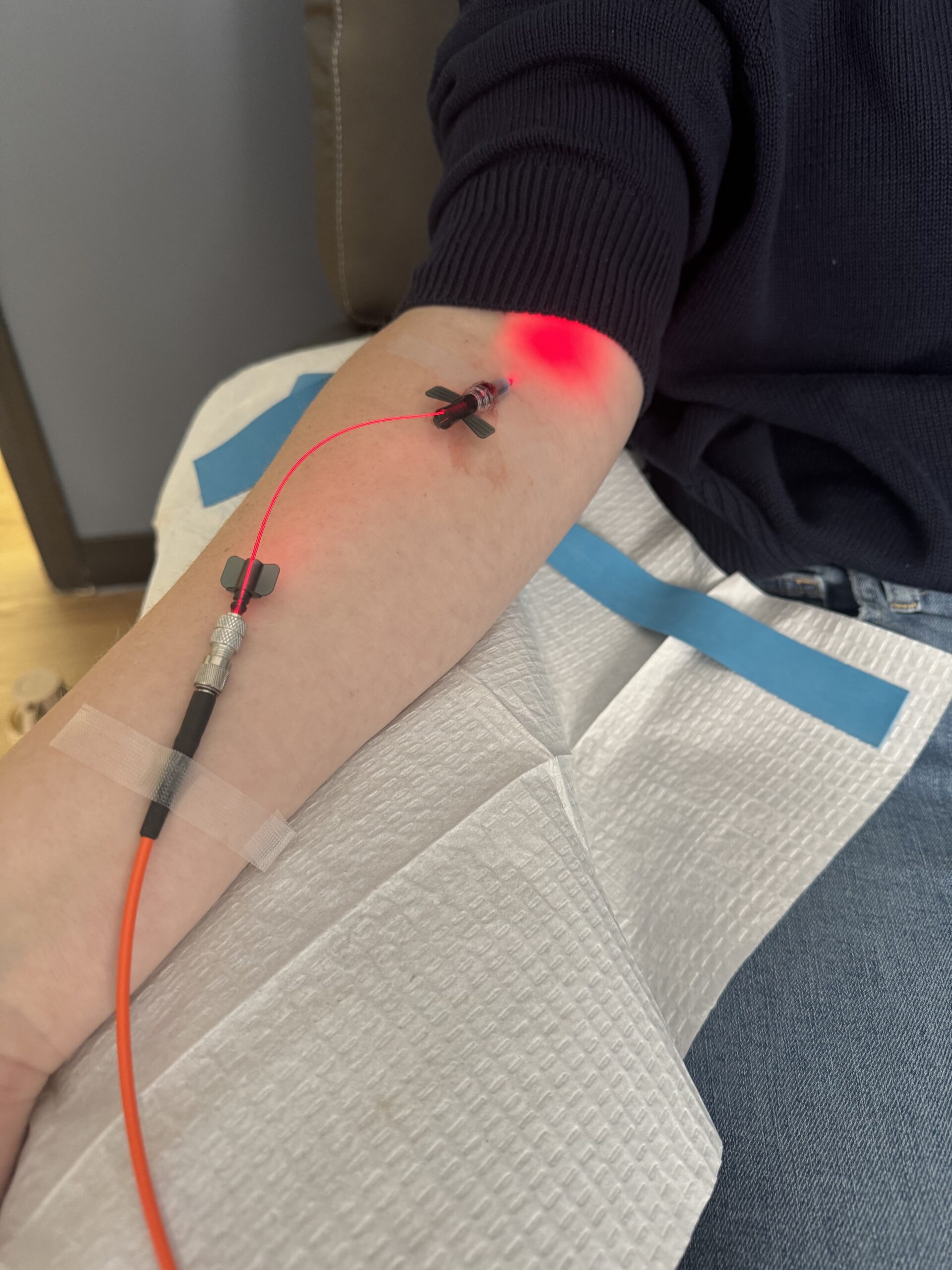 A picture of intravenous photodynamic therapy using red light