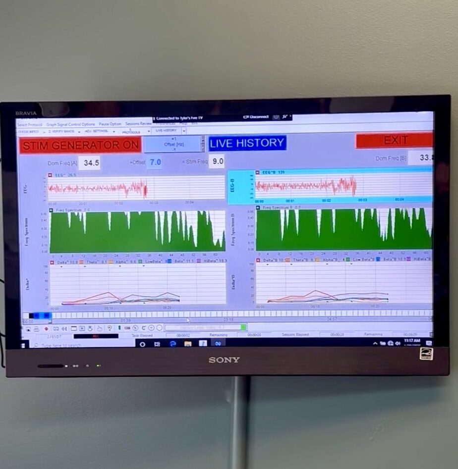 photo of neurofeedback screen during session